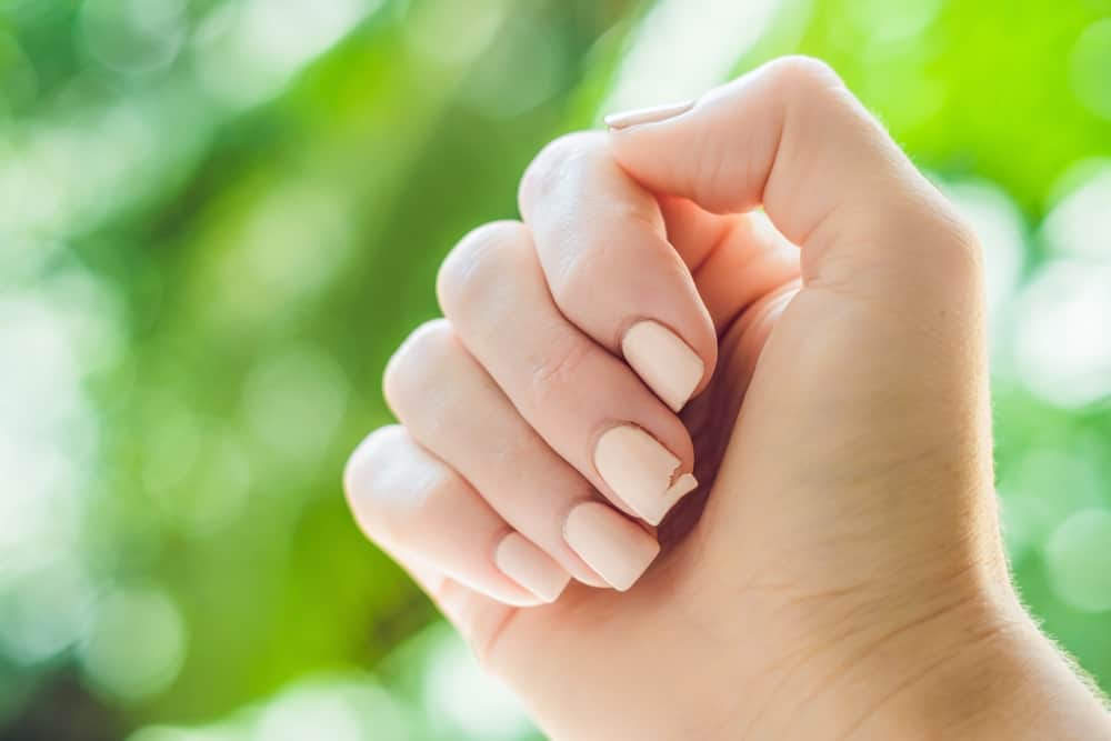 Broken nail on a woman's hand with a manicure