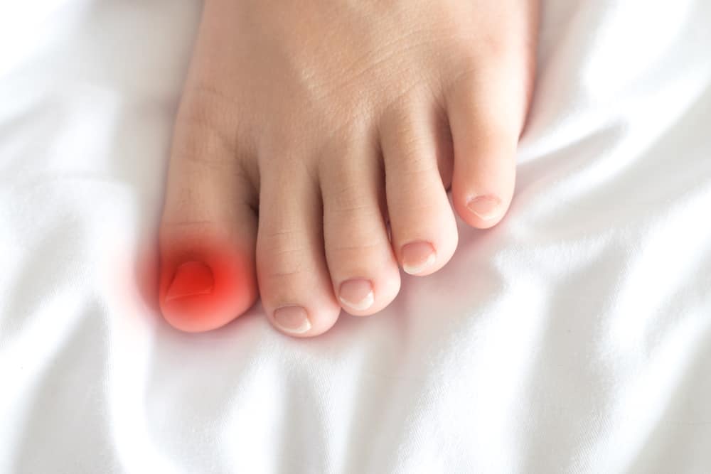 Foot of female Asia young adult with red spot on thumb