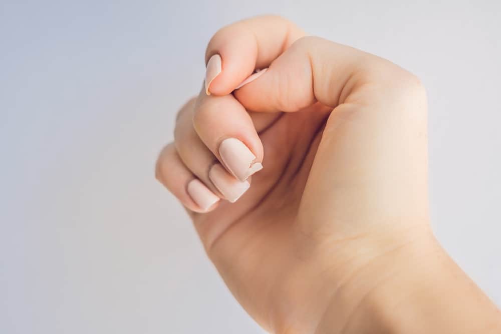 Broken nail on a woman's hand with a manicure