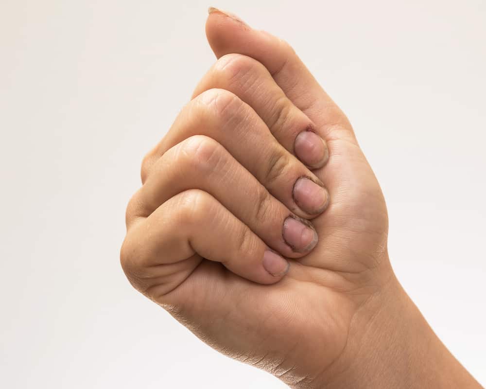 Female hands with dirty nails