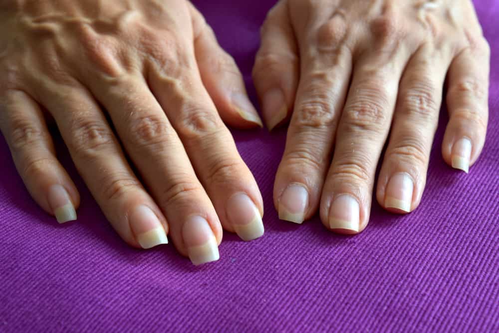 Female hands with ugly veins and different size nails on purple background