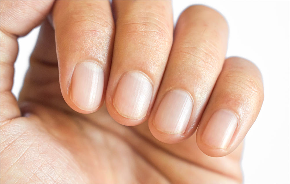 How To Fix Crooked Nails (Complete Guide) How To Fix Crooked Nails (Complete Guide)