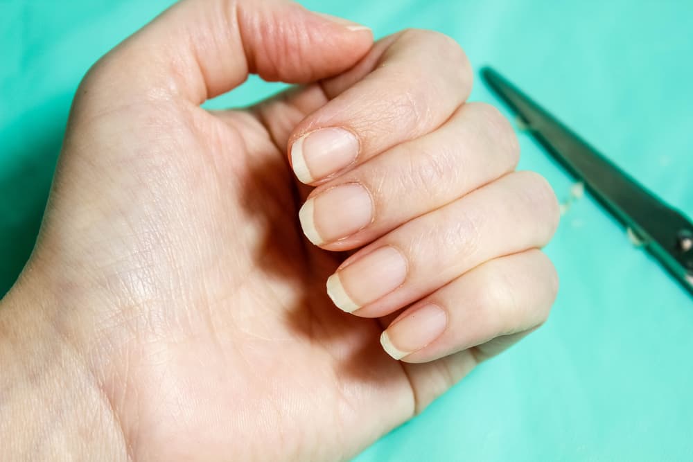 Uneven nails on women's hands that are crooked with scissors