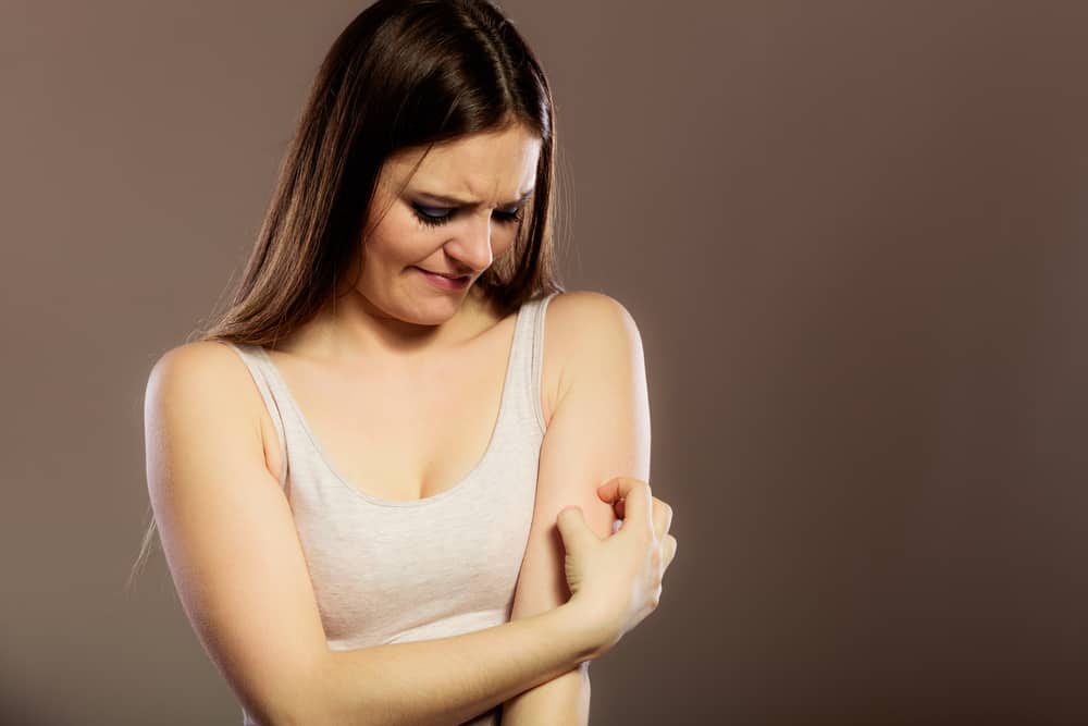 Woman scratching her arm