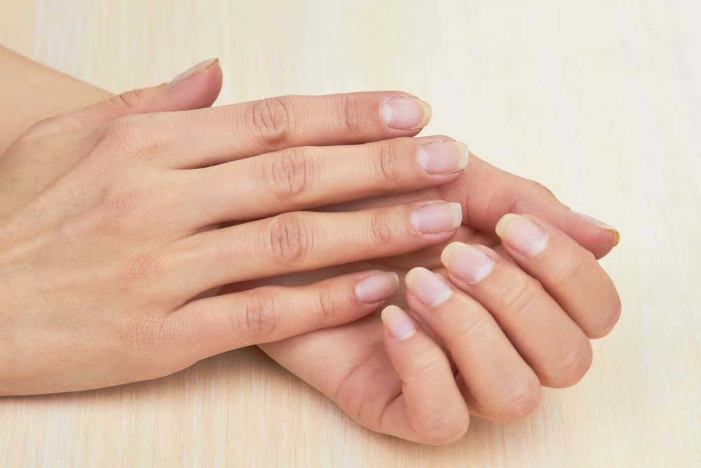 Female hands without varnish on nails